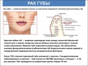 Информационные материалы по раннней диагностике новообразований полости рта и глотки