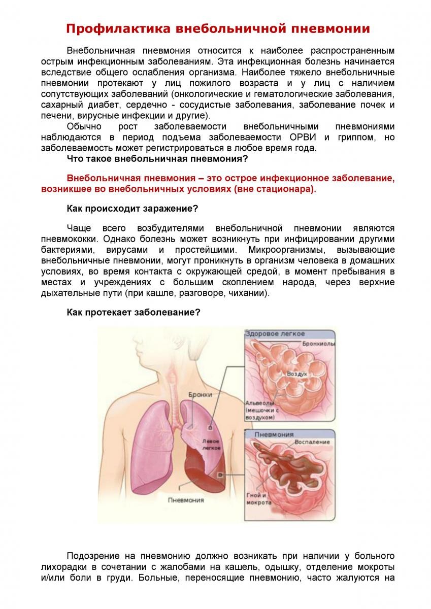 Профилактика пневмонии картинка