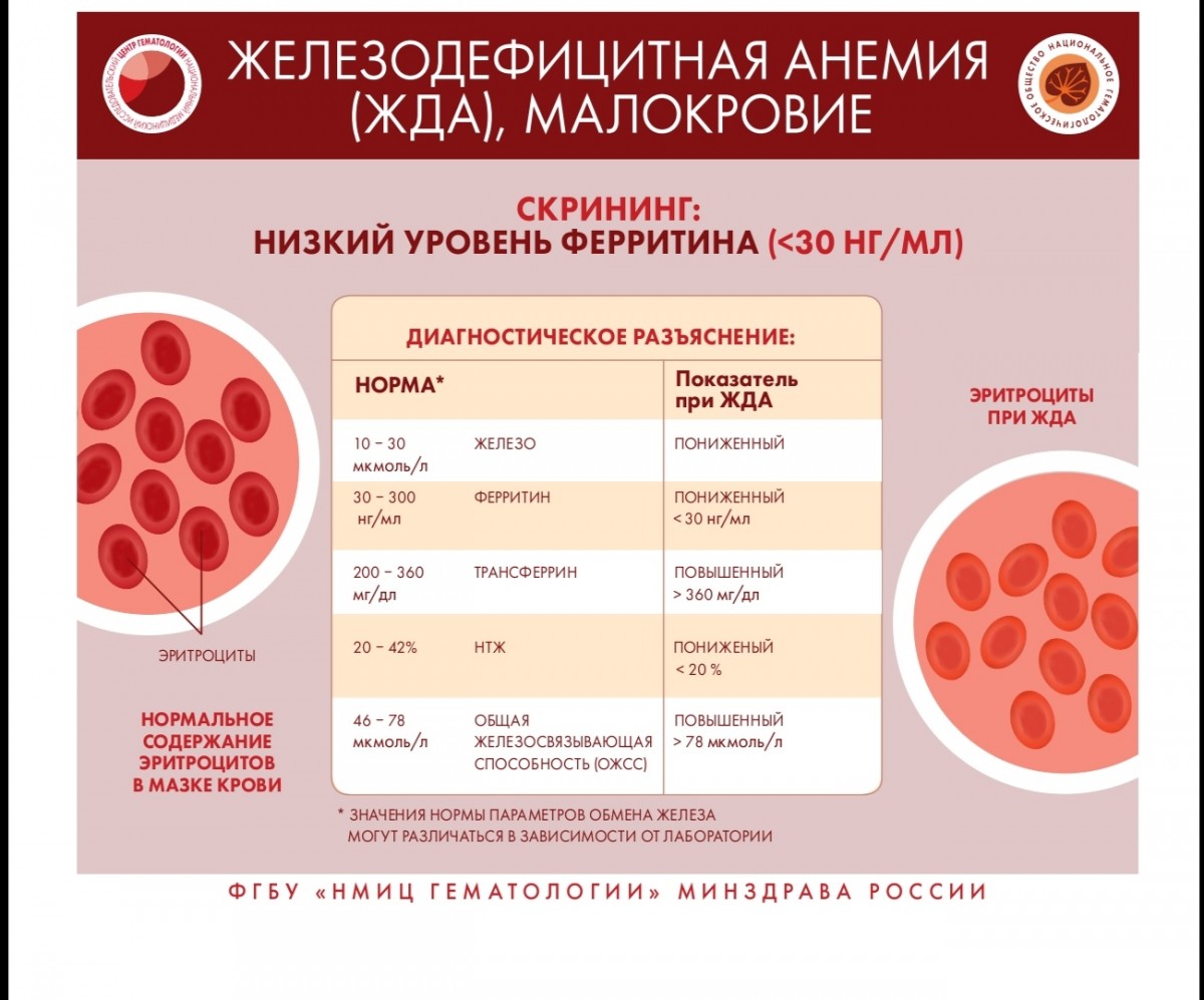 Признаки и симптомы неходжкинской лимфомы,